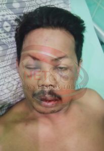 Korban Pengeroyokan di Desa Sumber Anyar Tiga Hari Masih Terbaring di UGD