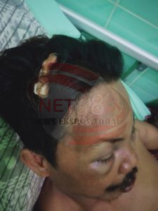 Tiga Orang Yang Diduga Pelaku 170 di Desa Sumberanyar, Tidak Diketahui Rimbanya
