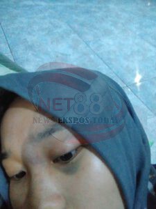 Penganiayaan Kembali Terjadi, Suami Aniaya Istri Siri