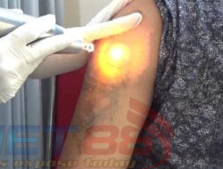 Hapus Tatto Gratis Dibulan Ramadhan Persembahan RS Bhayangkara Bondowoso